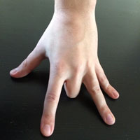 I ett förlamat finger kan du inte lyfta ringfingret - det är ett faktum