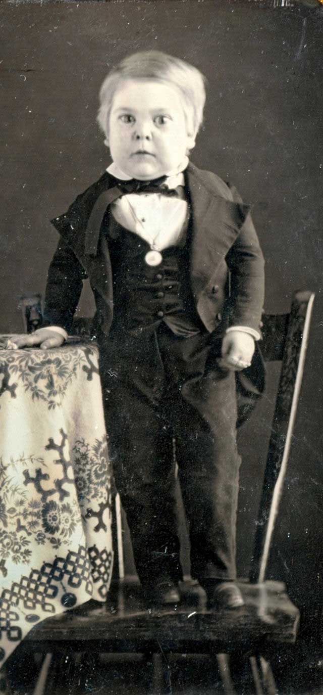 Fakta: Charles Stratton föddes 1838 och var bara 1 meter lång som vuxen eftersom han slutade växa som spädbarn